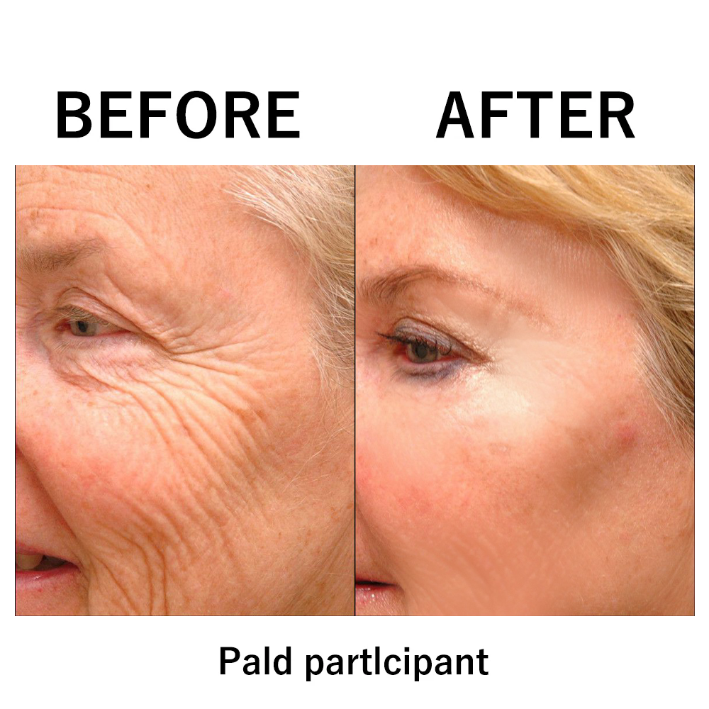 🔥 Limited-Time Sale: Instant Temporary Face Tightener – 87% OFF! ✨ Last Day Discount at the Official Brand Store!