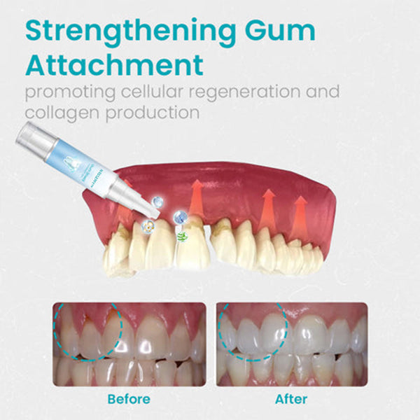 🔥Last Day Promotion 80% OFF-NESLEMY™ Gum Shield Therapy Gel