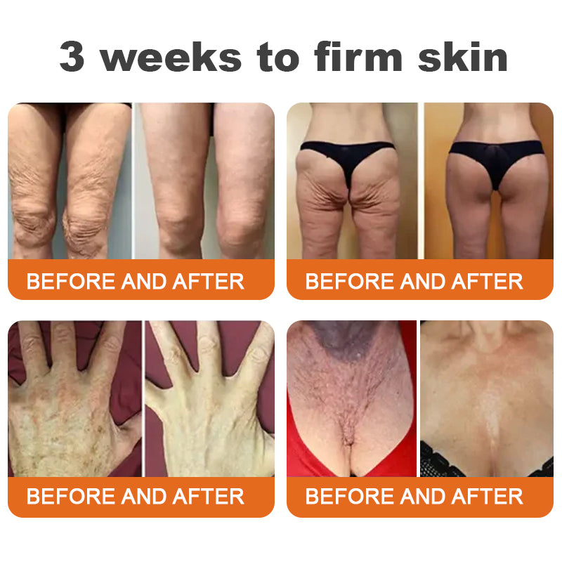 Made and Shipped from USA✨ Slimoly™ Bee Toxin Skin Repair Cream🔥 Last day 80% OFF💎💎
