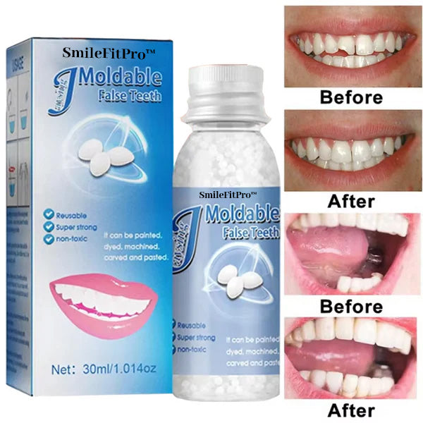 𦷠SmileFitPro⢠Dental Filling Gel ā Pain-Free, Drill-Free Cavity Solutionšš