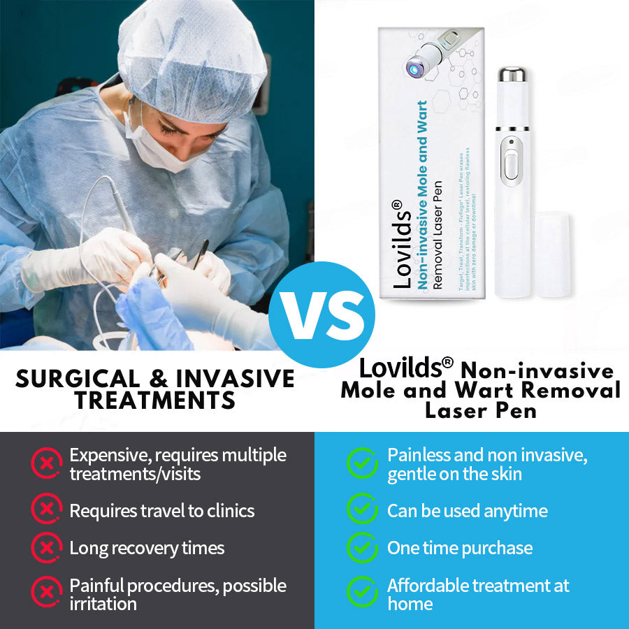 Lovilds® Non-Invasive Mole and Wart Removal Laser Pen