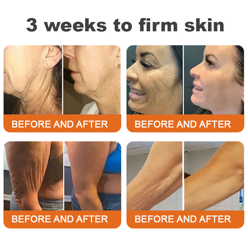 Made and Shipped from USA✨ Slimoly™ Bee Toxin Skin Repair Cream🔥 Last day 80% OFF💎💎