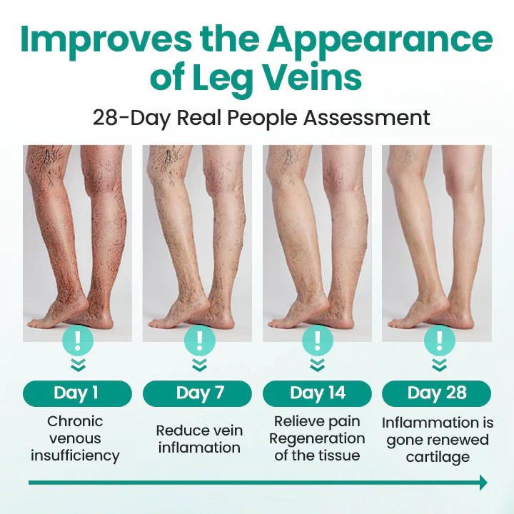 Newyuo® LegRenew Varicose Veins Patch