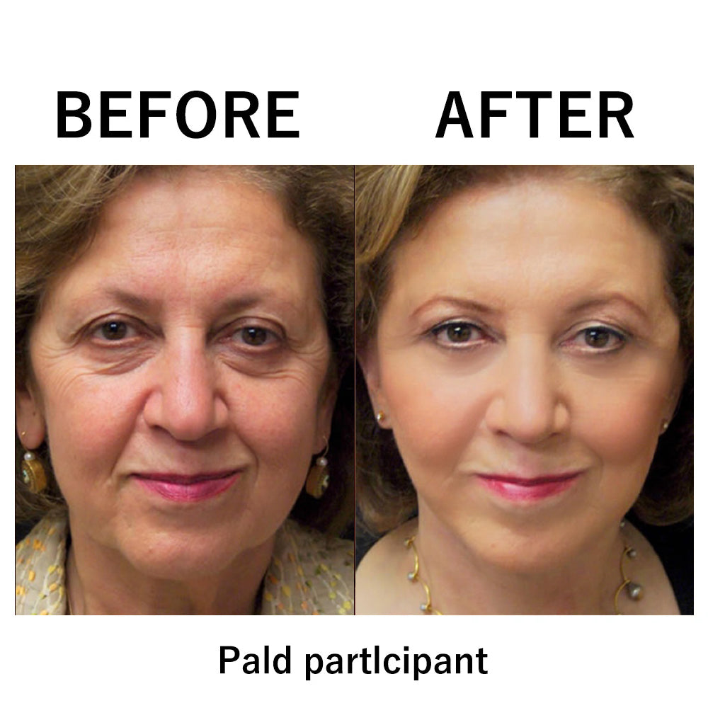 🔥 Limited-Time Sale: Instant Temporary Face Tightener – 87% OFF! ✨ Last Day Discount at the Official Brand Store!