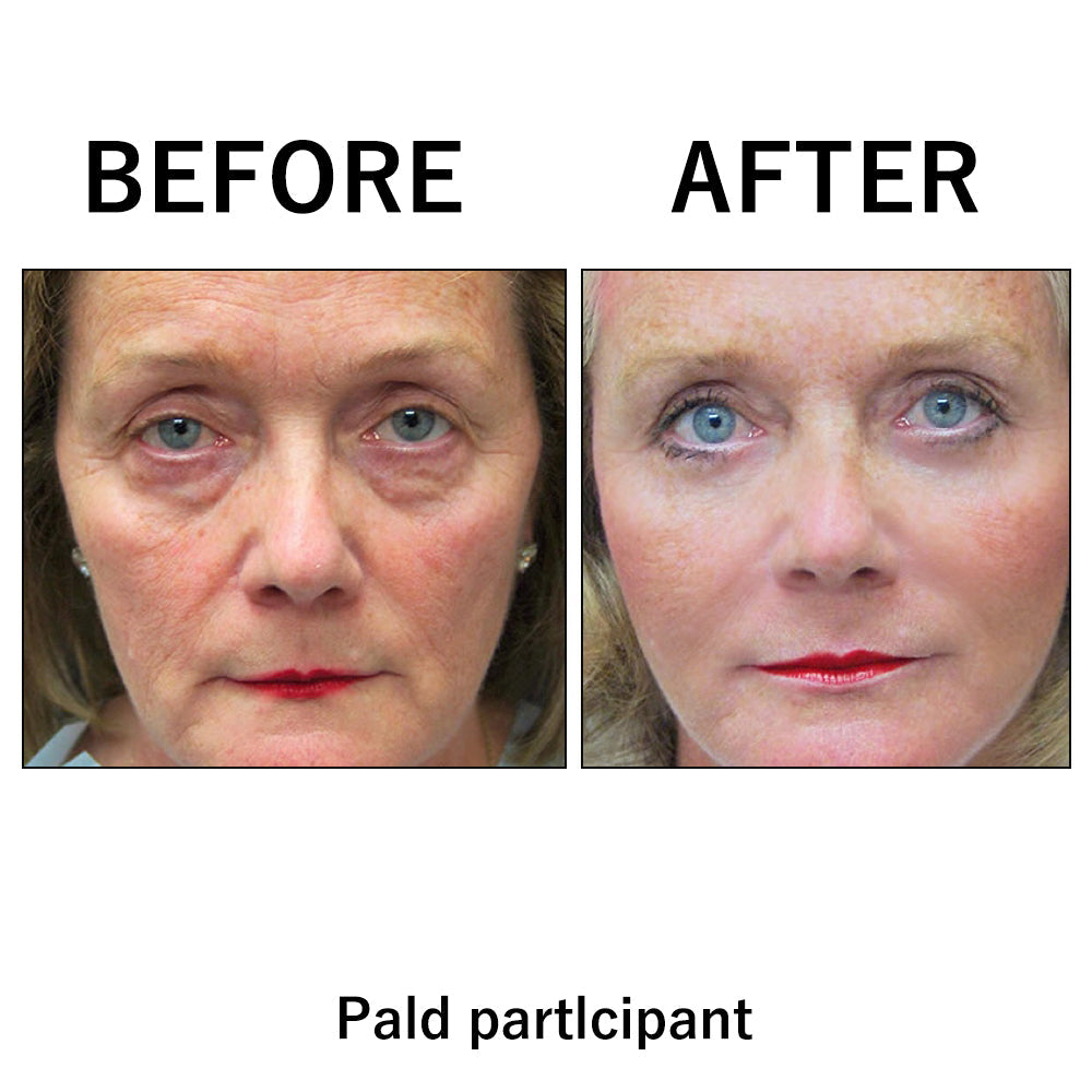 🔥 Limited-Time Sale: Instant Temporary Face Tightener – 87% OFF! ✨ Last Day Discount at the Official Brand Store!