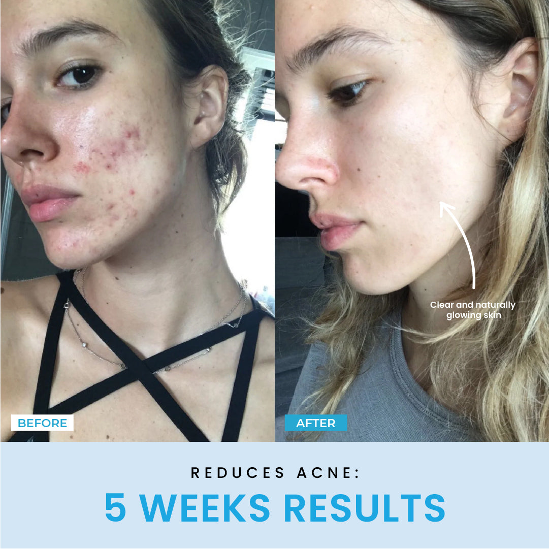 NESLEMY™ Face Sculptor literally + Free Serum