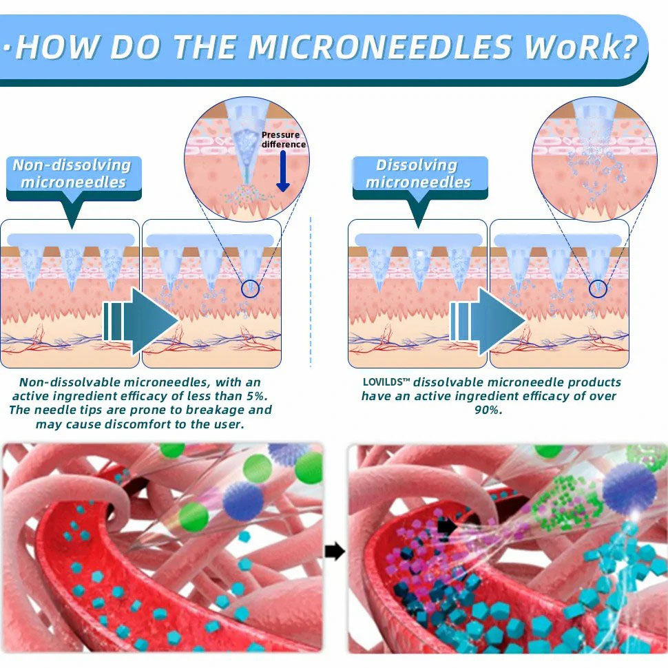 【LOVILDS™ Official Store】 NIDDK-Tirzepatide Nano Microneedle Patch (Zero Pain, 24/7 Release | Lose 20lbs FAST | 90% Sugar Drop | )