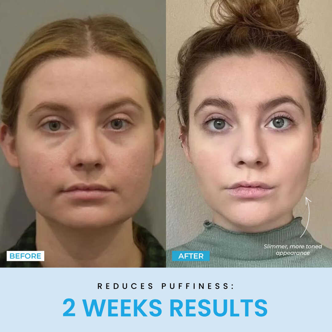 NESLEMY™ Face Sculptor literally + Free Serum