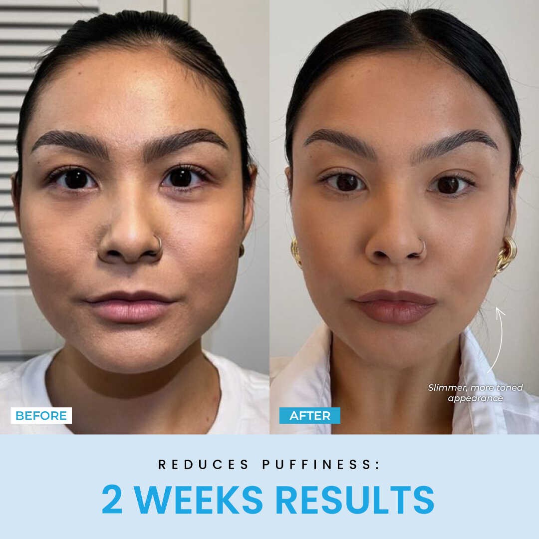 NESLEMY™ Face Sculptor literally + Free Serum
