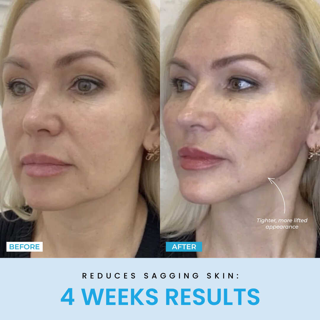 NESLEMY™ Face Sculptor literally + Free Serum