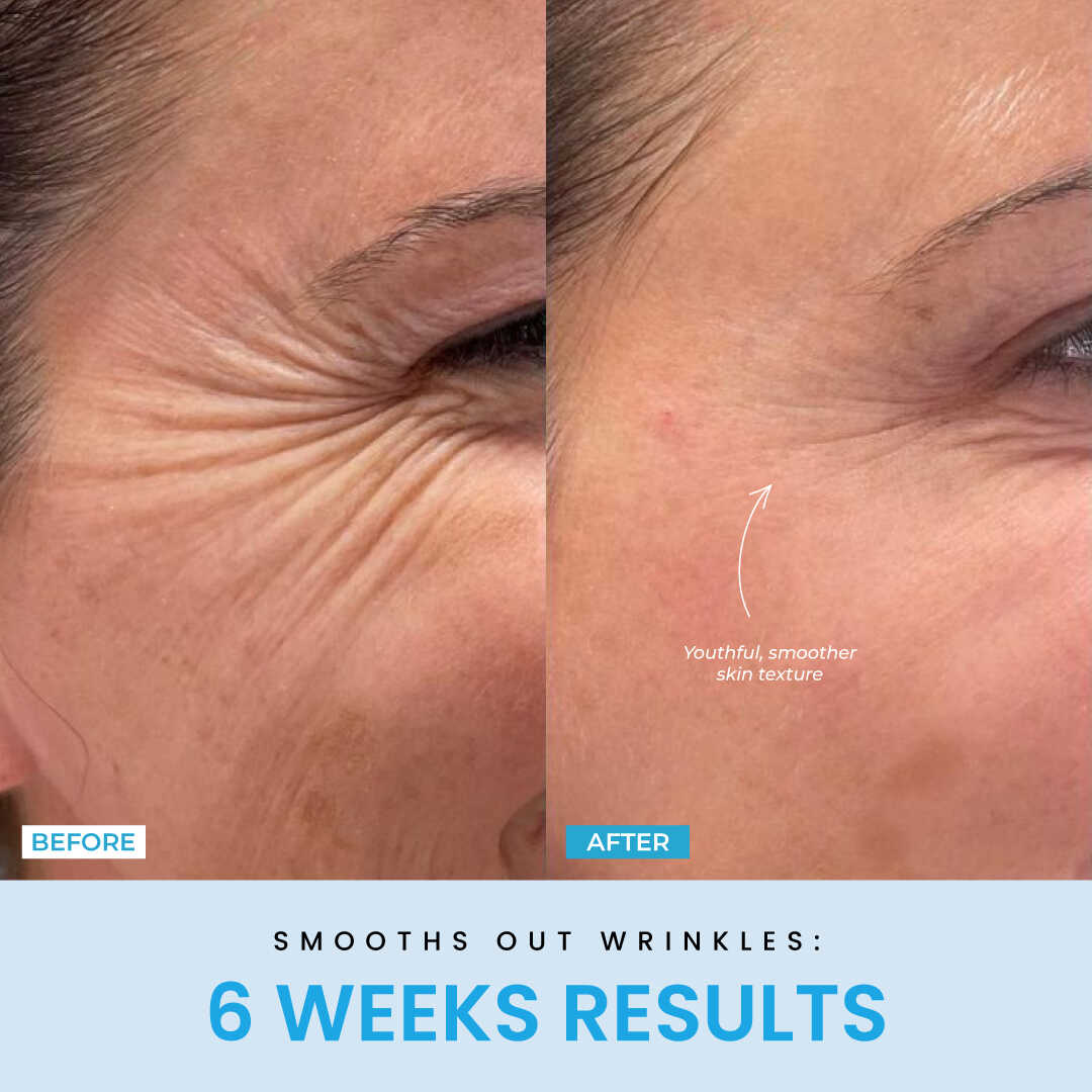 NESLEMY™ Face Sculptor literally + Free Serum