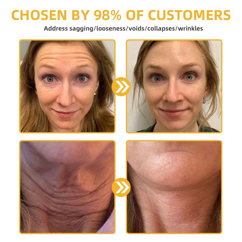 Official Store：Made and Shipped from USA🇺🇸Turonu Bee Venom Retinol Skin Salve Ointment 🐝𝐀𝐀𝐃 𝐑𝐄𝐂𝐎𝐌𝐌𝐄𝐍𝐃𝐒(🔥55% Off for a Limited Time!)