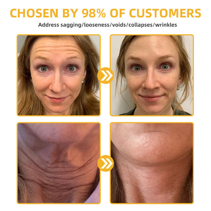Official Store：Made and Shipped from USA🇺🇸Turonu Bee Venom Retinol Skin Salve Ointment 🐝𝐀𝐀𝐃 𝐑𝐄𝐂𝐎𝐌𝐌𝐄𝐍𝐃𝐒(🔥55% Off for a Limited Time!)