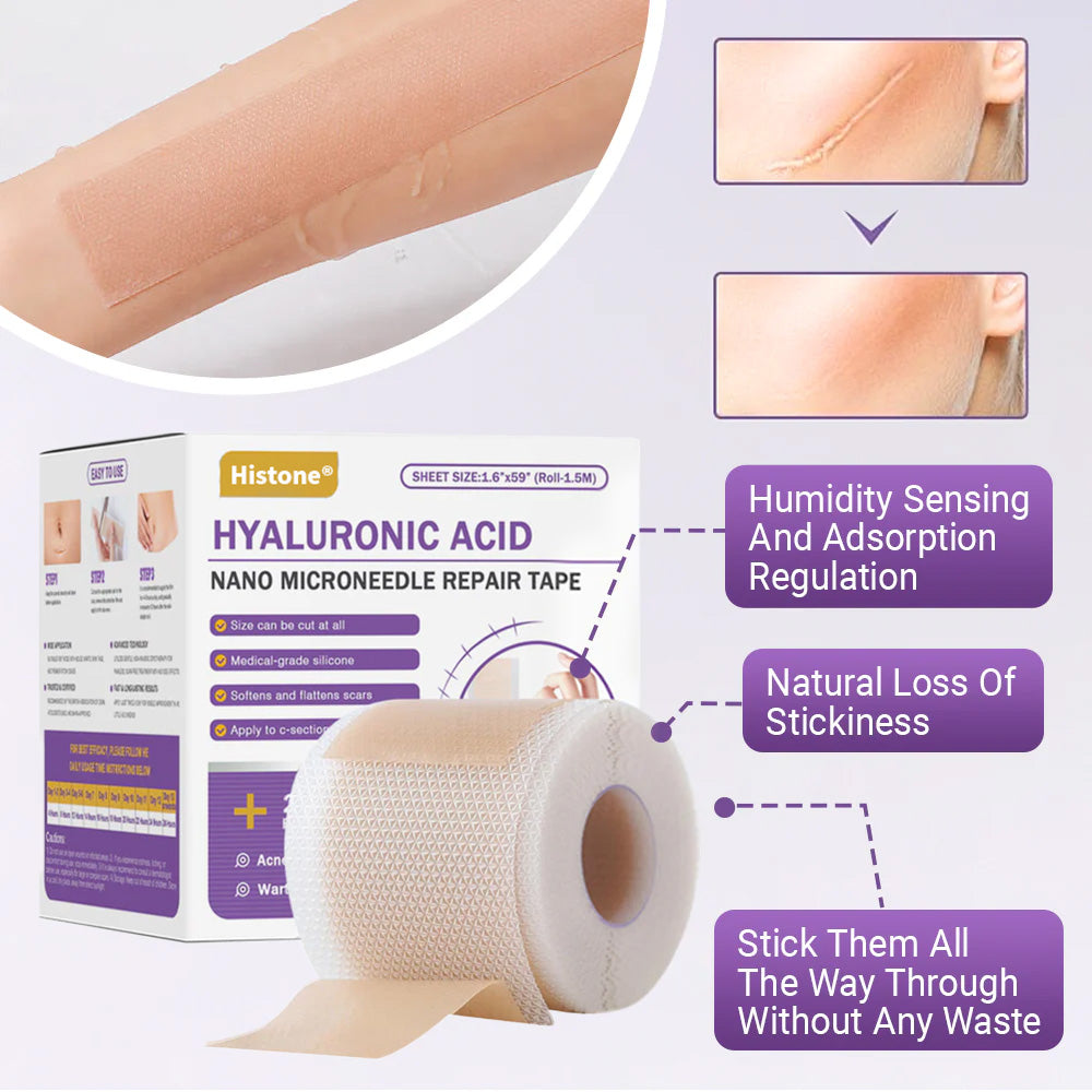 ✅Official Store |Histone® Hyaluronic Acid Nano Microneedle Repair Tape🍁🏥(Treatment of old and new scars, reduction of surgical scars, stretch marks, keloids, acne, burns, warts, dermatomes and varicose veins)
