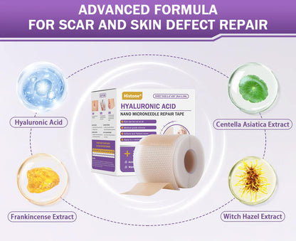 ✅Official Store |Histone® Hyaluronic Acid Nano Microneedle Repair Tape🍁🏥(Treatment of old and new scars, reduction of surgical scars, stretch marks, keloids, acne, burns, warts, dermatomes and varicose veins)