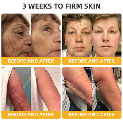 Official Store：Made and Shipped from USA🇺🇸Turonu Bee Venom Retinol Skin Salve Ointment 🐝𝐀𝐀𝐃 𝐑𝐄𝐂𝐎𝐌𝐌𝐄𝐍𝐃𝐒(🔥55% Off for a Limited Time!)