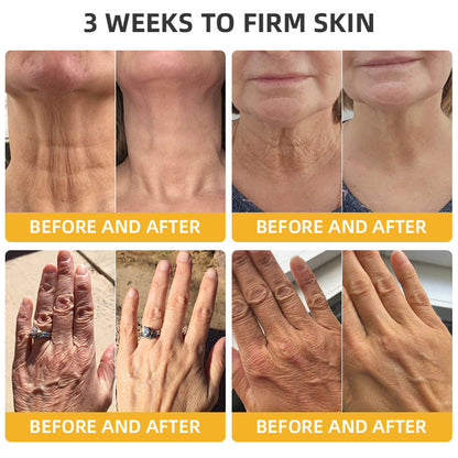 Official Store：Made and Shipped from USA🇺🇸Turonu Bee Venom Retinol Skin Salve Ointment 🐝𝐀𝐀𝐃 𝐑𝐄𝐂𝐎𝐌𝐌𝐄𝐍𝐃𝐒(🔥55% Off for a Limited Time!)
