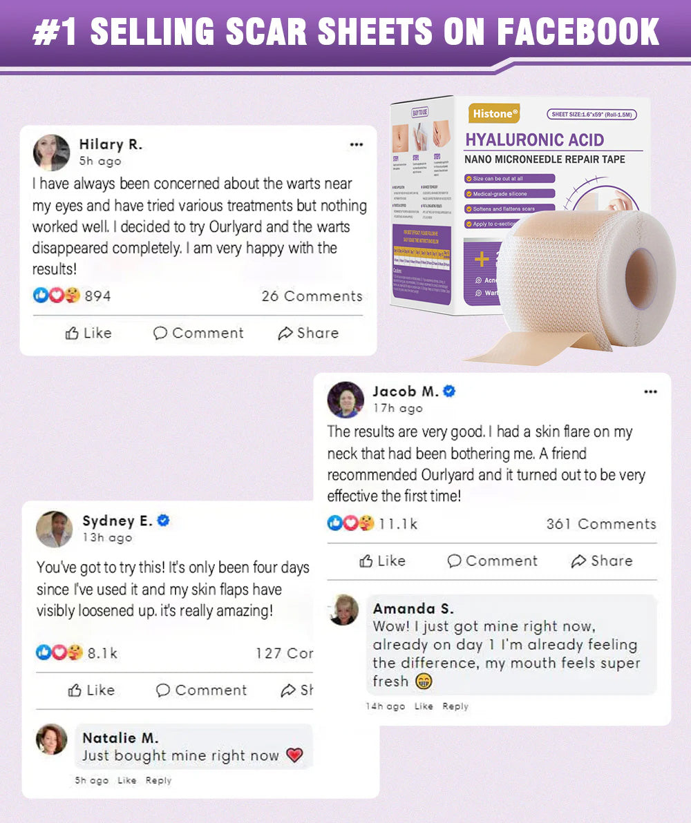 ✅Official Store |Histone® Hyaluronic Acid Nano Microneedle Repair Tape🍁🏥(Treatment of old and new scars, reduction of surgical scars, stretch marks, keloids, acne, burns, warts, dermatomes and varicose veins)