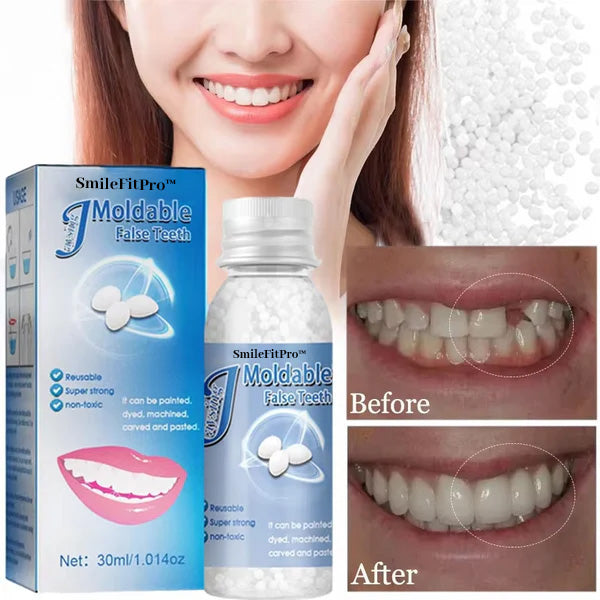 🦷 SmileFitPro™ Dental Filling Gel – Pain-Free, Drill-Free Cavity Solution💖💖