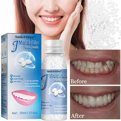 🦷 SmileFitPro™ Dental Filling Gel – Pain-Free, Drill-Free Cavity Solution💖💖