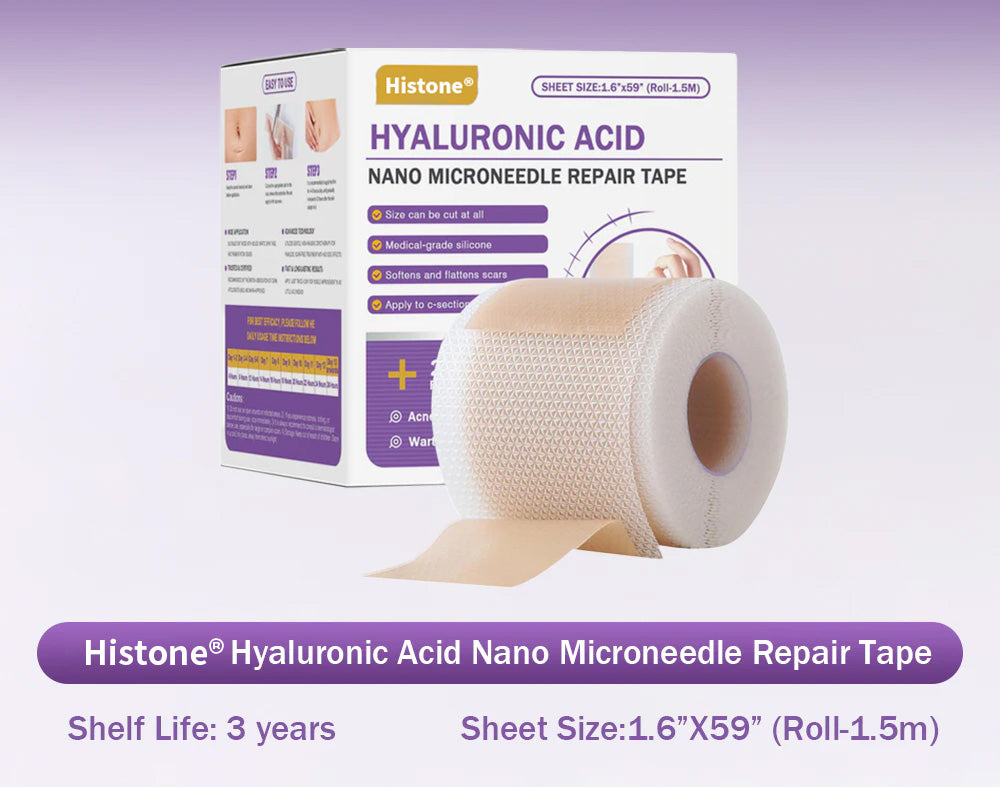 ✅Official Store |Histone® Hyaluronic Acid Nano Microneedle Repair Tape🍁🏥(Treatment of old and new scars, reduction of surgical scars, stretch marks, keloids, acne, burns, warts, dermatomes and varicose veins)