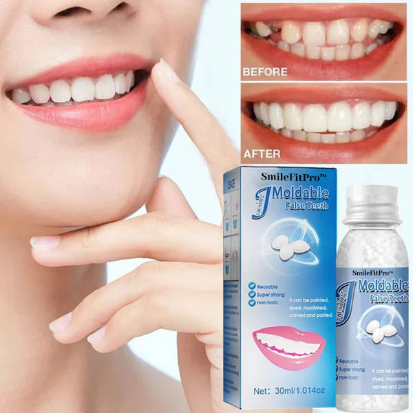 🦷 SmileFitPro™ Dental Filling Gel – Pain-Free, Drill-Free Cavity Solution💖💖