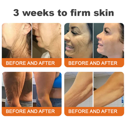 Made and Shipped from USA✨ Slimoly™ Bee Toxin Skin Repair Cream🔥 Last day 80% OFF💎💎
