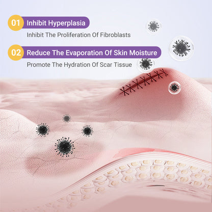 ✅Official Store |Histone® Hyaluronic Acid Nano Microneedle Repair Tape🍁🏥(Treatment of old and new scars, reduction of surgical scars, stretch marks, keloids, acne, burns, warts, dermatomes and varicose veins)