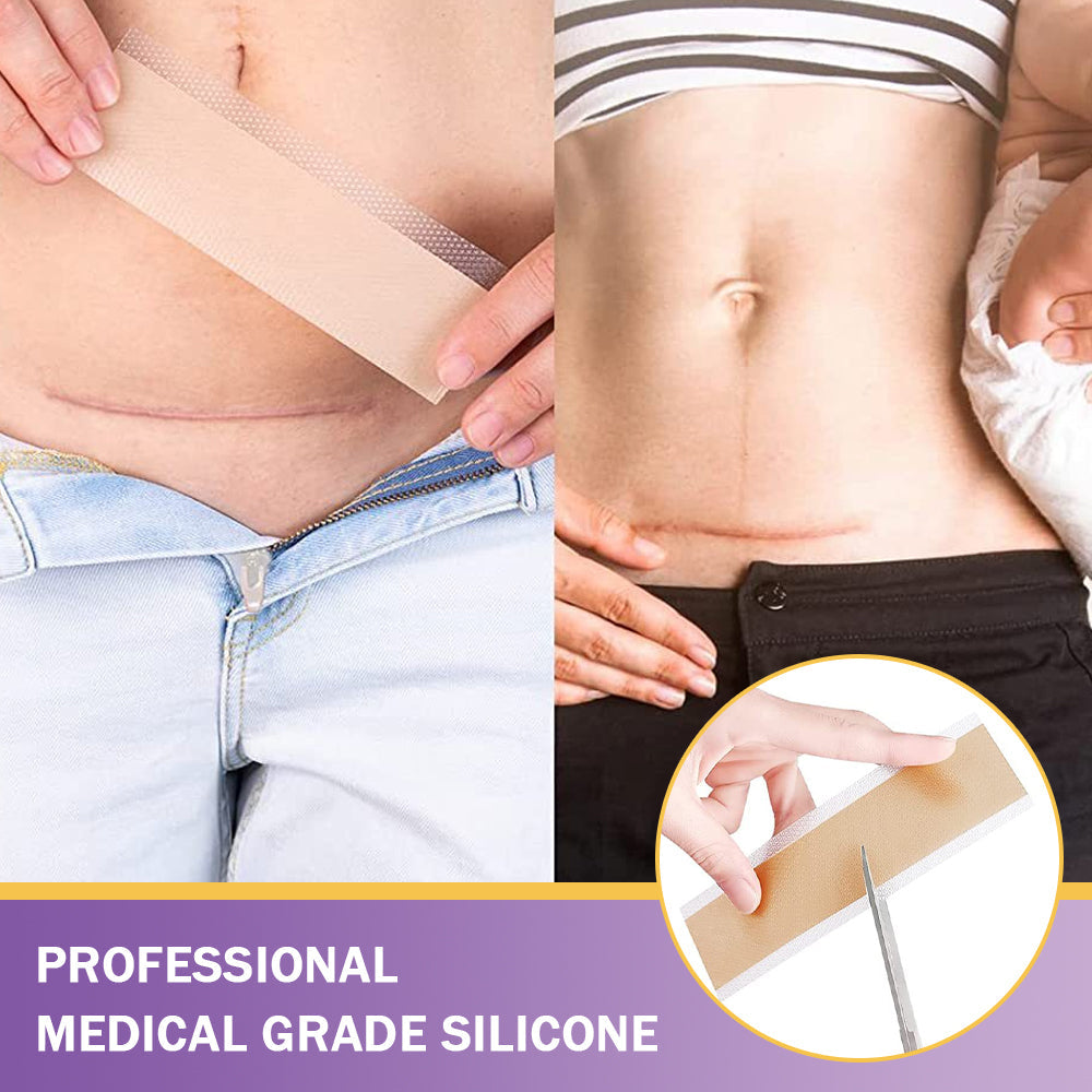 ✅Official Store |Histone® Hyaluronic Acid Nano Microneedle Repair Tape🍁🏥(Treatment of old and new scars, reduction of surgical scars, stretch marks, keloids, acne, burns, warts, dermatomes and varicose veins)