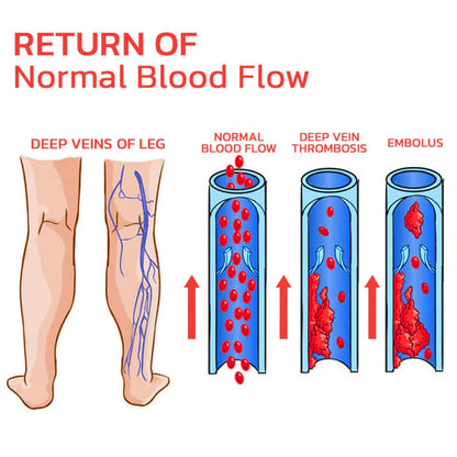 Lovilds™ VeinLess Immediate Relief Herbal Patch -✅ Clinically proven to eliminate varicose veins in just 7 days!