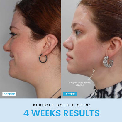 NESLEMY™ Face Sculptor literally + Free Serum