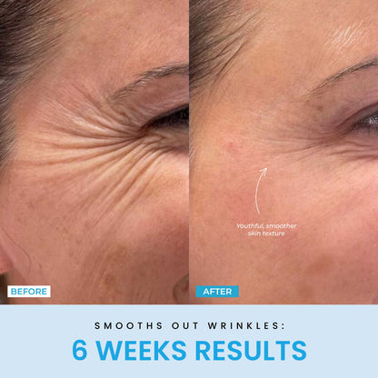 NESLEMY™ Face Sculptor literally + Free Serum